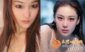 张馨予整容了吗 张馨予整容前后照对比