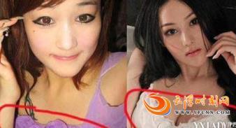 张馨予整容了吗 张馨予整容前后照对比