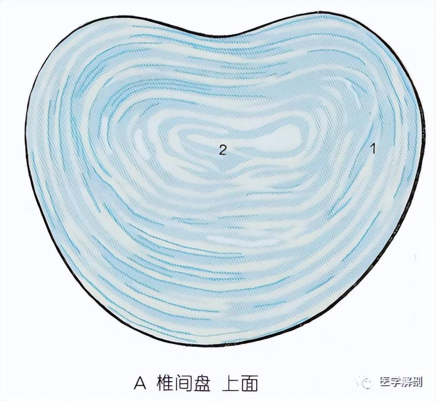 简单几幅图,鉴别椎间盘膨出、突出、脱出!