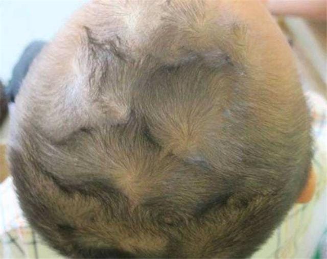 头上长两个旋的孩子聪明吗(头上2个旋的孩子太拧) 头上长两个旋的孩子聪明吗(头上2个旋的孩子太拧)