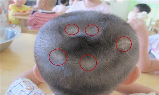 头上长两个旋的孩子聪明吗(头上2个旋的孩子太拧) 头上长两个旋的孩子聪明吗(头上2个旋的孩子太拧)