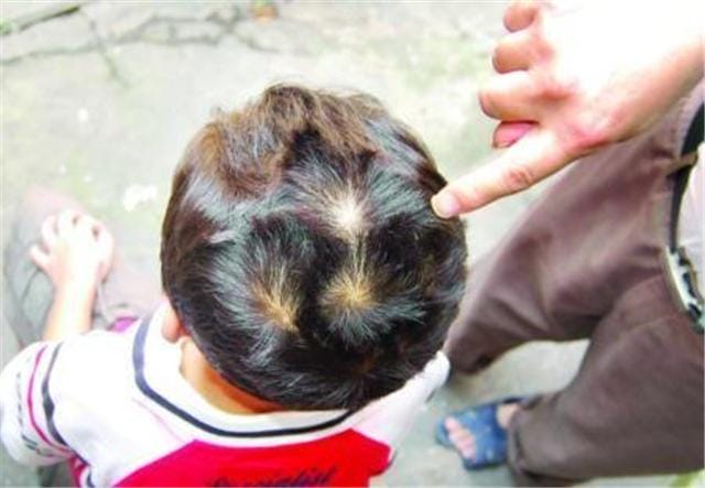 头上长两个旋的孩子聪明吗(头上2个旋的孩子太拧) 头上长两个旋的孩子聪明吗(头上2个旋的孩子太拧)
